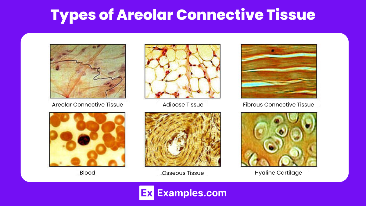 Types of Areolar Connective Tissue