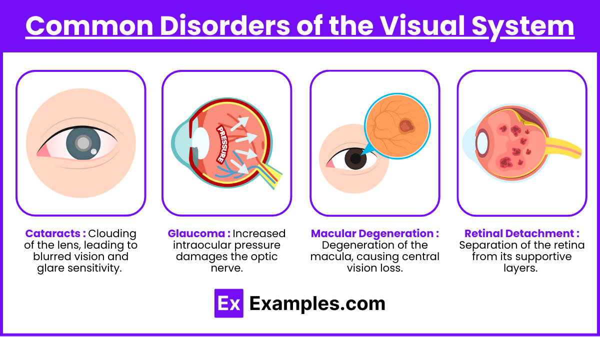 Common Disorders of the Visual System