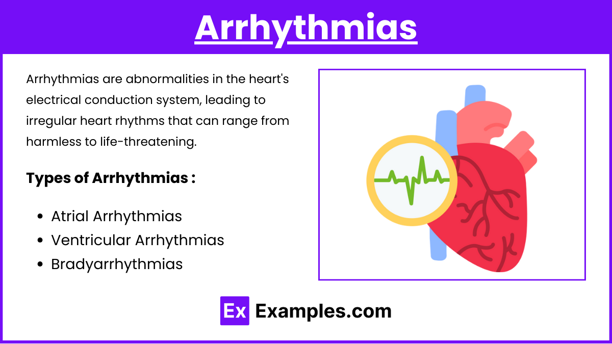 Arrhythmias