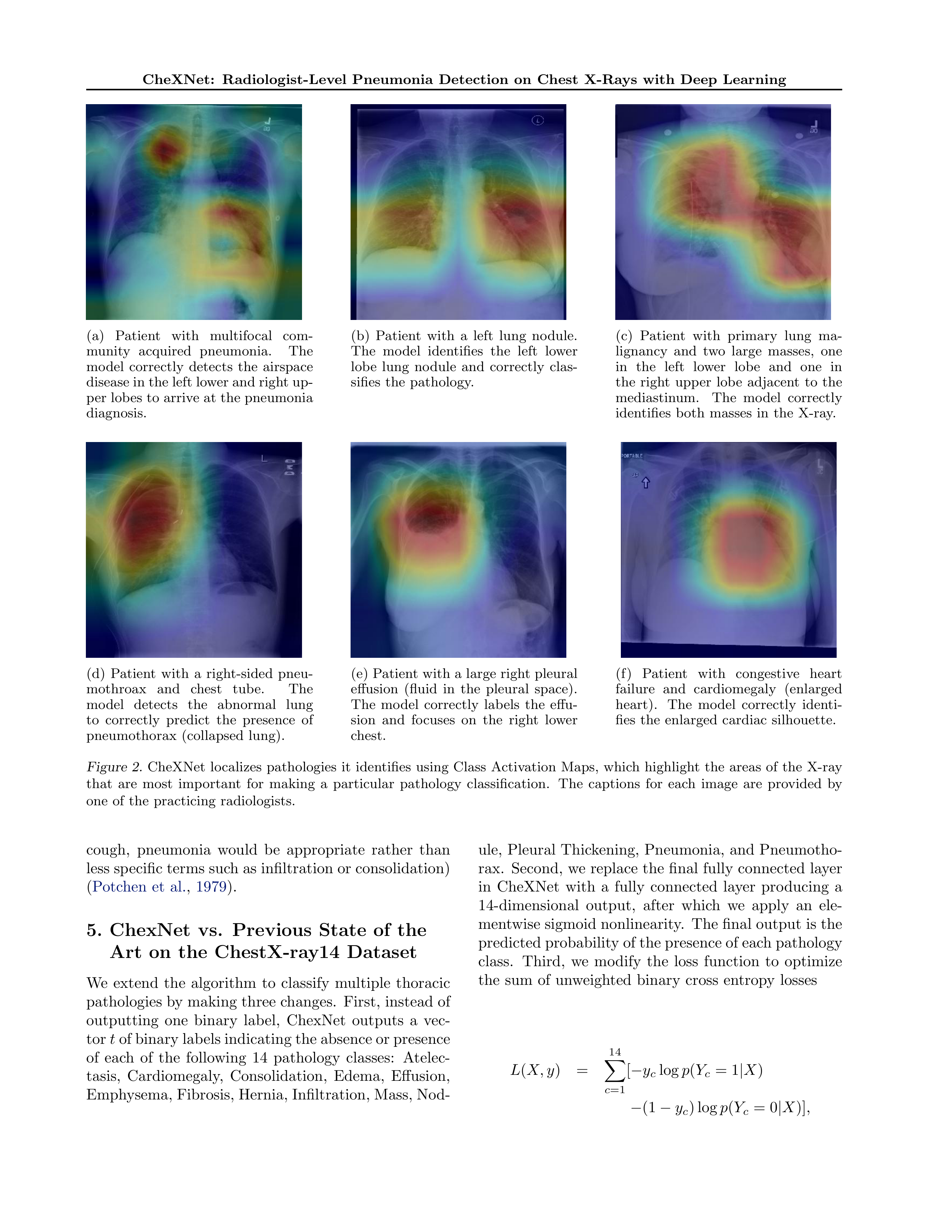 CheXNet Research Paper by Stanford University — page 4